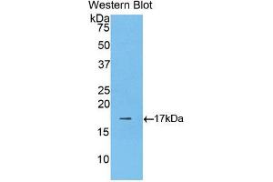 Western blot analysis of the recombinant protein. (LGALS9B Antikörper  (AA 17-148))