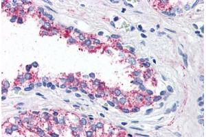 Anti-5HT1B Receptor antibody  ABIN1048254 IHC staining of human prostate.
