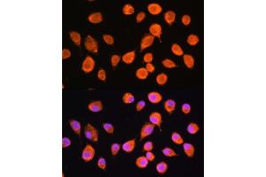 Immunofluorescence analysis of L929 cells using SMPD4 Rabbit pAb (ABIN7270531) at dilution of 1:100. (SMPD4 Antikörper  (AA 600-800))
