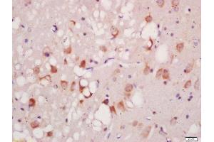 Formalin-fixed and paraffin embedded rat brain labeled with Anti-Phospho-ATG1(Ser556)Polyclonal Antibody, Unconjugated  at 1:200 followed by conjugation to the secondary antibody and DAB staining (ULK1 Antikörper  (pSer556))