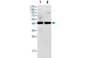 Western blot analysis of AMACR monoclonal antibody, clone 2A10F3  against Jurkat (1) and LNCaP (2) cell lysate. (AMACR Antikörper)