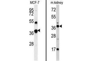 Image no. 1 for anti-Fructose-1,6-Bisphosphatase 1 (FBP1) (Middle Region) antibody (ABIN452992) (FBP1 Antikörper  (Middle Region))