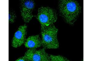A549 cells were stained with Cytokeratin 13 (5A3) Monoclonal Antibody  at [1:200] incubated overnight at 4C, followed by secondary antibody incubation, DAPI staining of the nuclei and detection. (Cytokeratin 13 Antikörper)