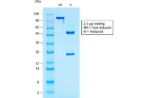SDS-PAGE Analysis Purified MUC1 Mouse Recombinant Monoclonal Antibody (rMUC1/960). (Rekombinanter MUC1 Antikörper)