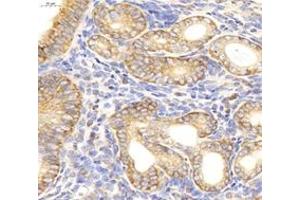 Immunohistochemistry (Paraffin-embedded Sections) (IHC (p)) image for anti-Insulin Receptor alpha (ISR-alpha) antibody (ABIN7074298)