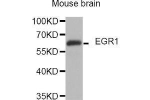Western blot analysis of extracts of mouse brain, using EGR1 antibody (ABIN5974370). (EGR1 Antikörper)