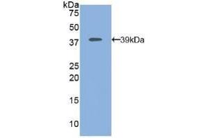 Detection of Recombinant MAP2K1, Human using Polyclonal Antibody to Mitogen Activated Protein Kinase Kinase 1 (MAP2K1) (MEK1 Antikörper  (AA 54-369))