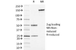 SDS-PAGE Analysis Purified CD13 Mouse Monoclonal Antibody (APN/1464). (CD13 Antikörper)