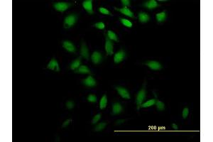 Immunofluorescence of purified MaxPab antibody to PSRC2 on HeLa cell. (ZFC3H1 Antikörper  (AA 1-358))