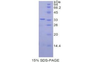 SDS-PAGE analysis of Human CREB Binding Protein. (CBP Protein)