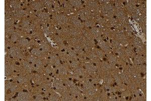 ABIN6278675 at 1/100 staining Rat brain tissue by IHC-P. (MAGEC1 Antikörper)