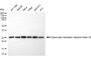 Western blotting analysis using eukaryotic translation initiation factor 4E antibody (ABIN7798528).