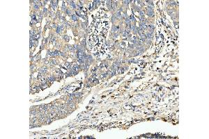 IHC analysis of CD63 using anti-CD63 antibody (ABIN3043395). (CD63 Antikörper  (AA 97-238))
