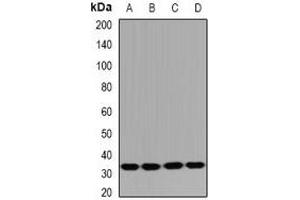Western blot analysis of HUS1B expression in Jurkat (A), mouse spleen (B), mouse thymus (C), rat testis (D) whole cell lysates. (HUS1B Antikörper)