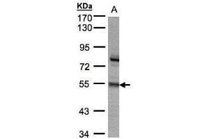 WB Image Sample(30 ug whole cell lysate) A:293T 7. (ZNF165 Antikörper)