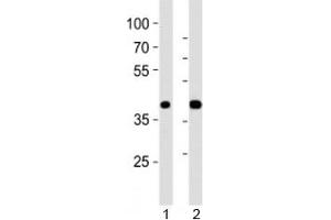 Western blot analysis of lysate from 1) mouse pancreas and 2) rat pancreas tissue using PDX1 antibody at 1:1000. (PDX1 Antikörper  (N-Term))