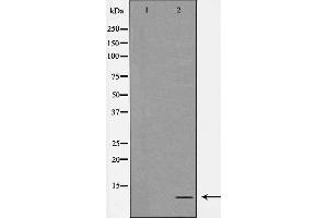 Western blot analysis of extracts from COLO cells, using ATP5I antibody. (ATP5I Antikörper  (C-Term))