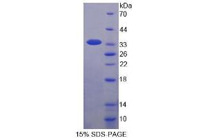 SDS-PAGE analysis of Human WWP2 Protein. (WWP2 Protein)