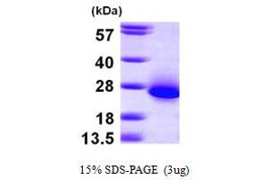 SDS-PAGE (SDS) image for Chromosome 6 Open Reading Frame 108 (C6orf108) (AA 1-174) protein (His tag) (ABIN667201)