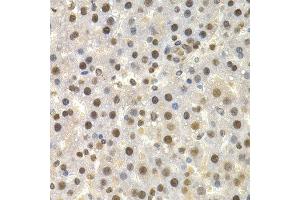 Immunohistochemistry of paraffin-embedded rat liver using TOR1A antibody at dilution of 1:200 (400x lens). (TOR1A Antikörper)