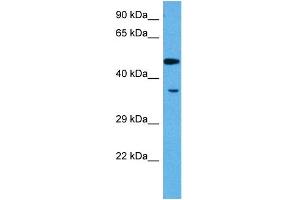 Host:  Rabbit  Target Name:  MEF2A  Sample Tissue:  Rat Skeletal Muscle  Antibody Dilution:  1ug/ml (MEF2A Antikörper  (N-Term))
