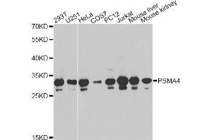 Western blot analysis of extracts of various cell lines, using PSMA4 antibody (ABIN6291447) at 1:1000 dilution. (PSMA4 Antikörper)