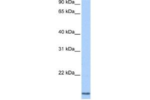 WB Suggested Anti-CCNL2 Antibody Titration:  0. (Cyclin L2 Antikörper  (N-Term))