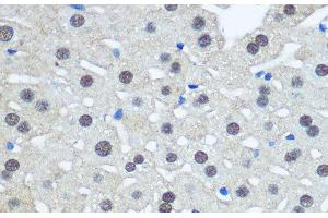 Immunohistochemistry of paraffin-embedded Rat liver using UBA1 Polyclonal Antibody at dilution of 1:100 (40x lens). (UBA1 Antikörper)