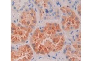 Immunohistochemistry (IHC) image for anti-Mannosidase, Alpha, Class 2B, Member 1 (MAN2B1) (AA 883-1011) antibody (ABIN1869071)