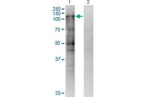 Western Blot analysis of MSH2 expression in transfected 293T cell line by MSH2 monoclonal antibody (M02), clone 4B2. (MSH2 Antikörper  (AA 835-934))