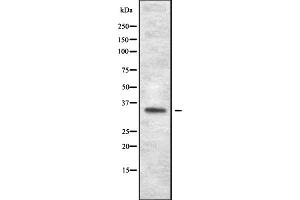 Western blot analysis of OR1J1 expression in HEK293 cells ,The lane on the left is treated with the antigen-specific peptide. (OR1J1 Antikörper)