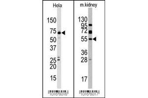 Western blot analysis of anti-JMJD4 (C-term) Pab in Hela and mouse kidney cell line lysate. (JMJD4 Antikörper  (C-Term))