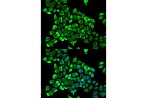 Immunofluorescence analysis of MCF-7 cells using CDA antibody. (CDA Antikörper  (AA 1-146))