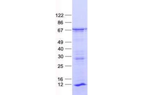 ZNF460 Protein (His tag)