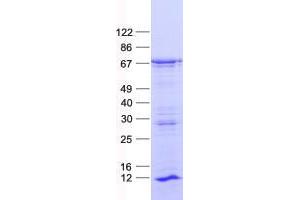 Validation with Western Blot (ZNF460 Protein (His tag))