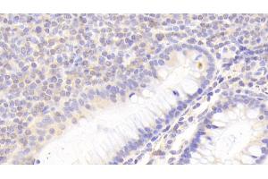 Detection of KLRC2 in Human Colon Tissue using Polyclonal Antibody to Killer Cell Lectin Like Receptor Subfamily C, Member 2 (KLRC2) (KLRC2 Antikörper  (AA 19-190))