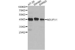 Western blot analysis of extracts of various cell lines, using NDUFV1 antibody. (NDUFV1 Antikörper)