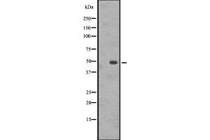 Western blot analysis of GASR expression in A431 whole cell lysate ,The lane on the left is treated with the antigen-specific peptide. (CCKBR Antikörper  (N-Term))