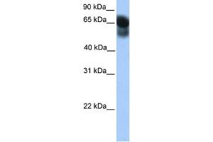 WB Suggested Anti-ATG16L1 Antibody Titration: 0. (ATG16L1 Antikörper  (Middle Region))
