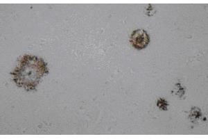 Immunohistochemistry (IHC) image for anti-Amyloid beta (Abeta) (AA 1-16), (N-Term) antibody (ABIN1105360) (beta Amyloid Antikörper  (N-Term))