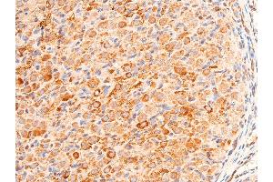 ABIN6267073 at 1/100 staining rat ovarian tissue sections by IHC-P. (CHEK1 Antikörper  (pSer280))