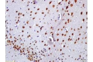 Formalin-fixed and paraffin embedded rat brain labeled with Anti-BASP1 Polyclonal Antibody, Unconjugated  at 1:200 followed by conjugation to the secondary antibody and DAB staining