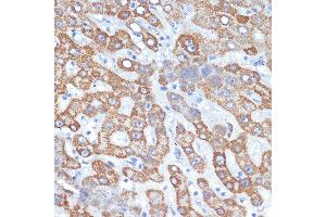 Immunohistochemistry of paraffin-embedded human liver using HMGCS2 Rabbit mAb (ABIN7265328) at dilution of 1:100 (40x lens). (HMGCS2 Antikörper)