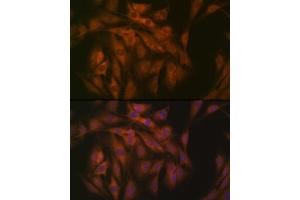 Immunofluorescence analysis of C6 cells using eIF3B Rabbit mAb (ABIN7267042) at dilution of 1:100 (40x lens). (EIF3B Antikörper)