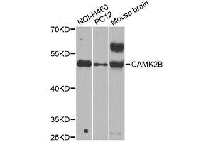 Western blot analysis of extracts of various cell lines, using CAMK2B antibody. (CAMK2B Antikörper  (AA 1-300))