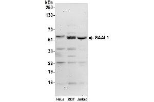 anti-serum Amyloid A-Like 1 (SAAL1) (AA 424-474) antibody