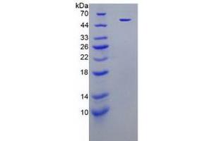 SDS-PAGE analysis of Human Neutrophil Elastase Protein (Recombinant). (ELANE Protein)