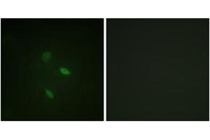 Immunofluorescence analysis of NIH-3T3 cells, using Cyclin E2 (Ab-392) Antibody.