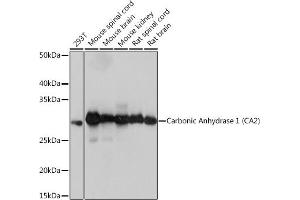 Western blot analysis of extracts of various cell lines, using Carbonic Anhydrase 2 (C) Rabbit mAb (ABIN7266070) at 1:1000 dilution.