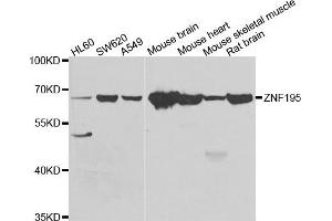 Western blot analysis of extracts of various cell lines, using ZNF195 antibody.